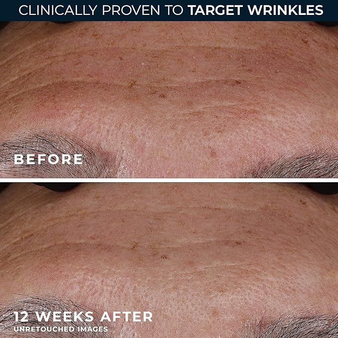 Anti Aging Serum | Hydration Serum for Wrinkles for Men & Women | Day Night